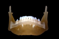 Zagadnienia medyczne w Katedrze Konstrukcji Maszyn